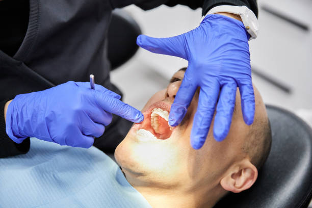 Best Emergency Treatment for Dental Infections or Abscesses in Washgton, IN